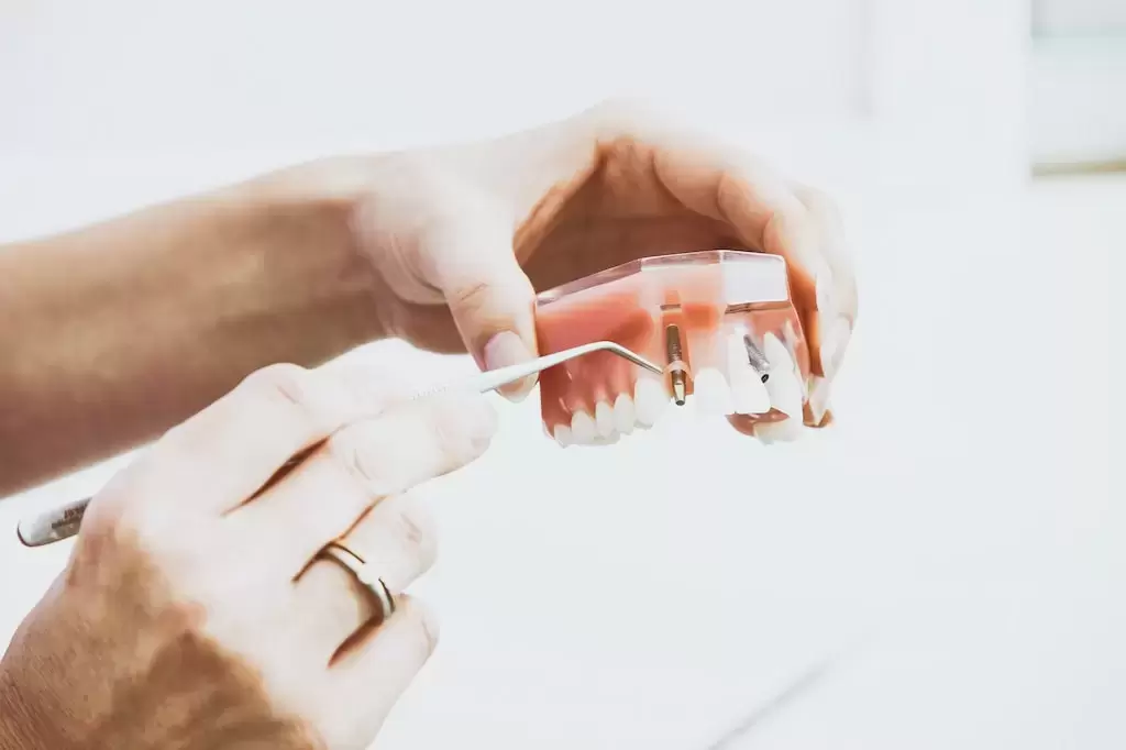 Implanty zębów Kraków - dlaczego stają się coraz popularniejsze? 